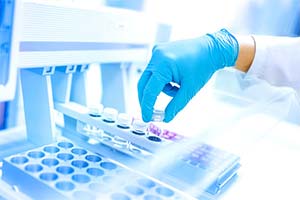 Product Stability Testing in Biologics