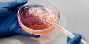 Prevention and Detection of Viral and Bacterial Contamination, Viral Clearance Strategies Masterclass